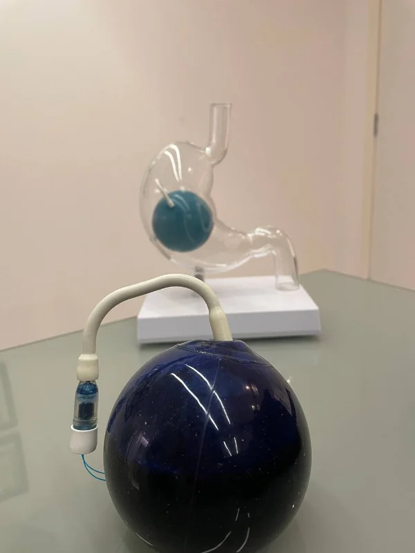 Balão gástrico