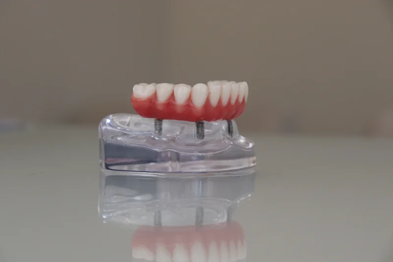 Implantes e protocolo
